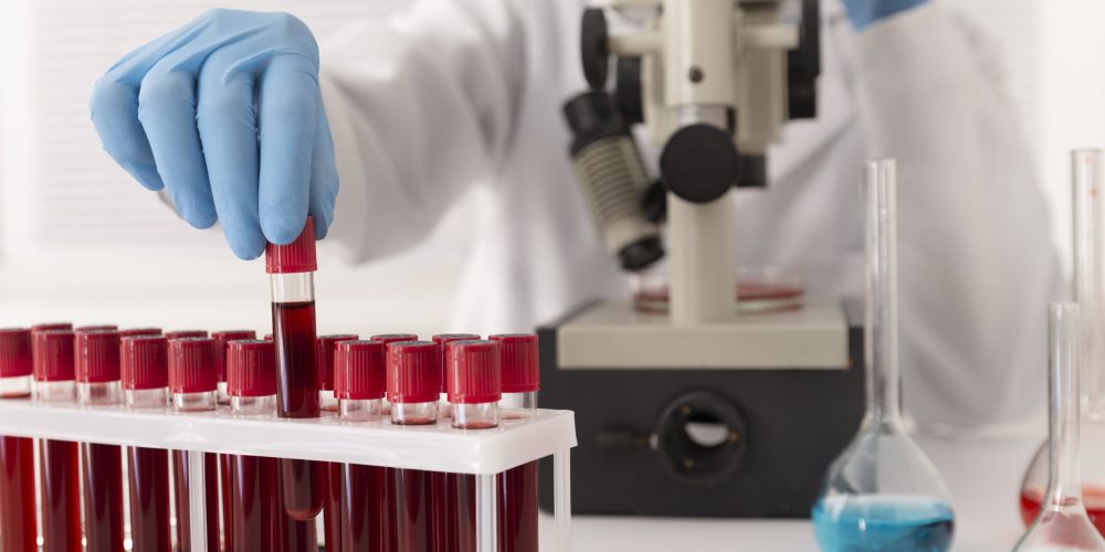 arrangement-d-echantillons-de-sang-de-coronavirus-en-laboratoire