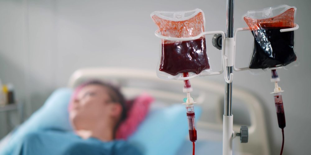 Blood transfusion to young woman patient in hospital bed. Female patient or donor lying in bed and receiving blood transfusion or donating blood in clinic ward